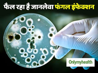 तेजी से फैल रहा है खतरनाक फंगल इंफेक्शन, 45% मरीजों की 90 दिन के भीतर मौत