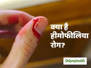 World Hemophilia Day 2022: खतरनाक हीमोफीलिया रोग में बंद नहीं होता शरीर से बहता खून, जानें अन्य लक्षण