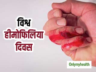 World Hemophilia Day: पुरुषों में ज्‍यादा क्‍यों होती है हीमोफिलिया की समस्‍या, जानें कारण और बचाव