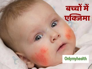 नवजात के शरीर पर लाल दाने और चकत्ते हो सकते हैं एक्जिमा का संकेत, पैरेंट्स बरतें ये सावधानियां  