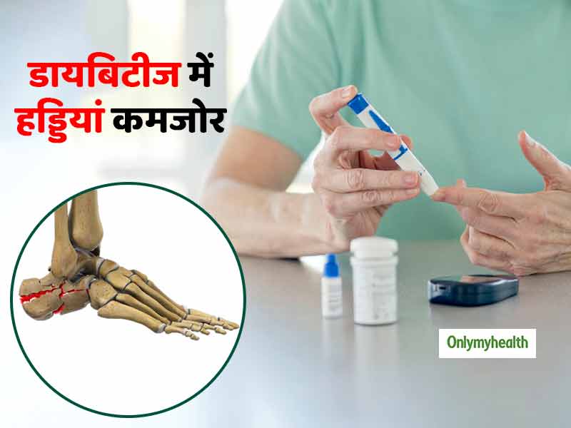 डायबिटीज से हड्डियां भी हो सकती हैं कमजोर, ये लक्षण दिखने पर बरतें सावधानी