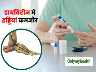 डायबिटीज से हड्डियां भी हो सकती हैं कमजोर, ये लक्षण दिखने पर बरतें सावधानी