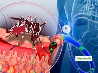 Dengue Prevention: किस मौसम में  खतरनाक होता है डेंगू बुखार और कैसे बचें इस जानलेवा रोग से, जानें