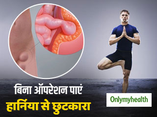 Hernia Treatment: हार्निया का बिना ऑपरेशन के भी हो सकता है उपचार, जानिए ये 3 आसान तरीके