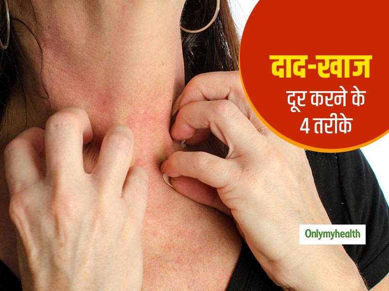 Monsoon Tips: मानूसन में दाद, खाज और खुजली से रहना है दूर तो करें ये 4 घरेलू नुस्खे, दर्द से मिलेगी राहत 