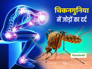 चिकनगुनिया में होने वाले जोड़ों के दर्द से कैसे पाएं छुटकारा? जानें क्यों खतरनाक है चिकनगुनिया बुखार