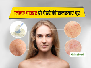 चेहरे पर पिंपल्स, दाग-धब्बों को दूर कर इंस्टैंट ग्लो लाता है मिल्क पाउडर, जानें प्रयोग का सही तरीका