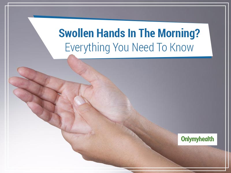 Swollen Fingers: Common Causes and Treatment Tips