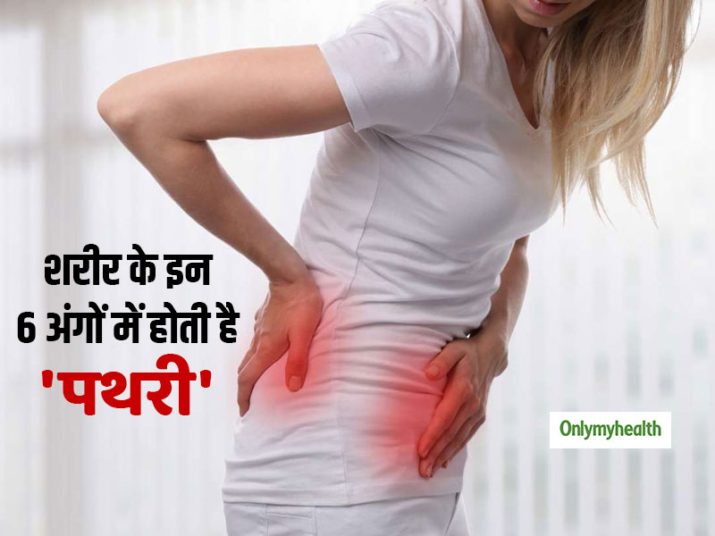 गुर्दे में ही नहीं बल्कि मुंह और नाक में भी होती है पथरी, जानें ऐसे 6 अंग जिनमें होती है पथरी  