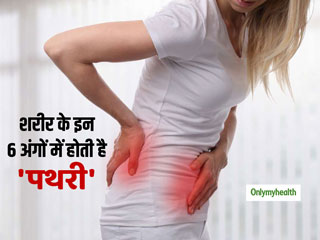 गुर्दे में ही नहीं बल्कि मुंह और नाक में भी होती है पथरी, जानें ऐसे 6 अंग जिनमें होती है पथरी  