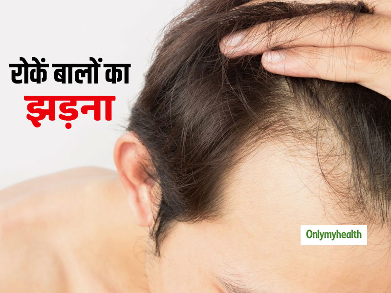 6 Most Common Reason of Hairfall in Men in Hindi | बालों के झड़ने का कारण  हो सकती हैं लड़कों की ये 6 गलतियां, जानें कैसे रोकें हेयर फॉल