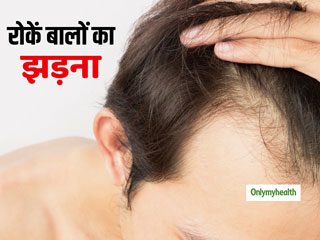 Hair Fall: बालों के झड़ने का कारण हो सकती हैं लड़कों की ये 6 गलतियां, जानें कैसे रोकें हेयर फॉल 