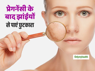 Post Pregnancy Skin Care: डिलीवरी के बाद आम है झाईयों और मुंहासों की समस्या, ये तरीका है सबका रामबाण