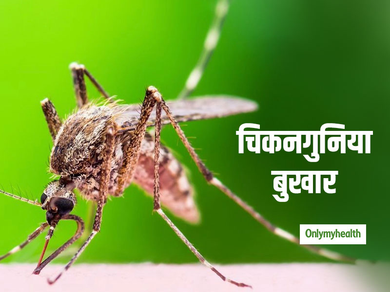 जानें मच्छर के काटने के बाद कैसे फैलता है चिकनगुनिया का वायरस और क्या हैं इसके लक्षण