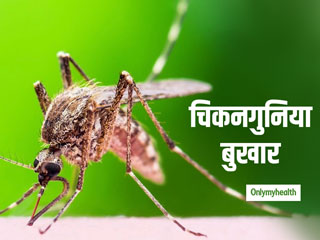 जानें मच्छर के काटने के बाद कैसे फैलता है चिकनगुनिया का वायरस और क्या हैं इसके लक्षण