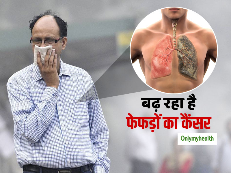 Lung Cancer: दिल्ली में 30 साल से कम उम्र के युवाओं में बढ़ा फेफड़ों का कैंसर, सिगरेट न पीने वाले भी शिकार