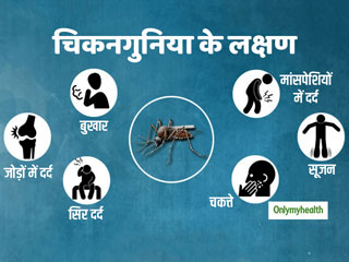 Chikungunya Fever : जोड़ों में दर्द, थकान और तेज बुखार हैं चिकनगुनिया के लक्षण, जानें बचाव का सही तरीका