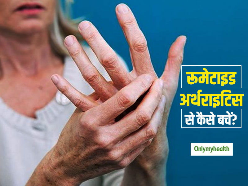 महिलाओं में 3 गुना ज्यादा होता है रूमेटाइड अर्थराइटिस का खतरा, एक्सपर्ट से जानें बचाव के टिप्स