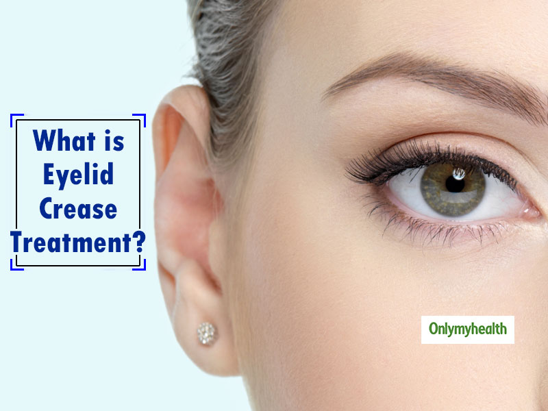 Eyelid Crease Treatment Here’s The Complete Guide On It