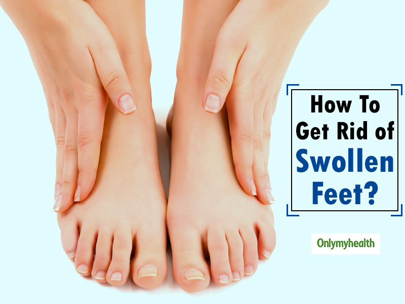 Home Remedies To Treat Swollen Ankles And Feet | OnlyMyHealth
