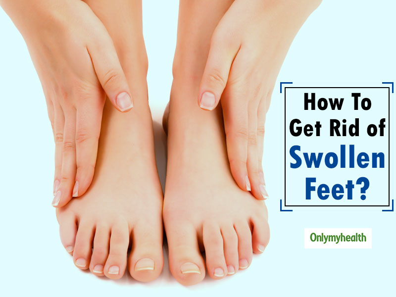 Does Walking Help Swollen Feet