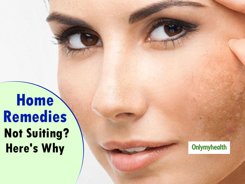 Home Remedy Hacks: Lemon, Aloe Vera Or Milk May Not Be Beneficial For Every Skin Type