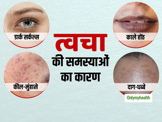 त्वचा की इन 4 समस्याओं का कारण बनती है आपकी खराब डाइट, जानें खूबसूरत त्वचा के लिए क्या खाना चाहिए?
