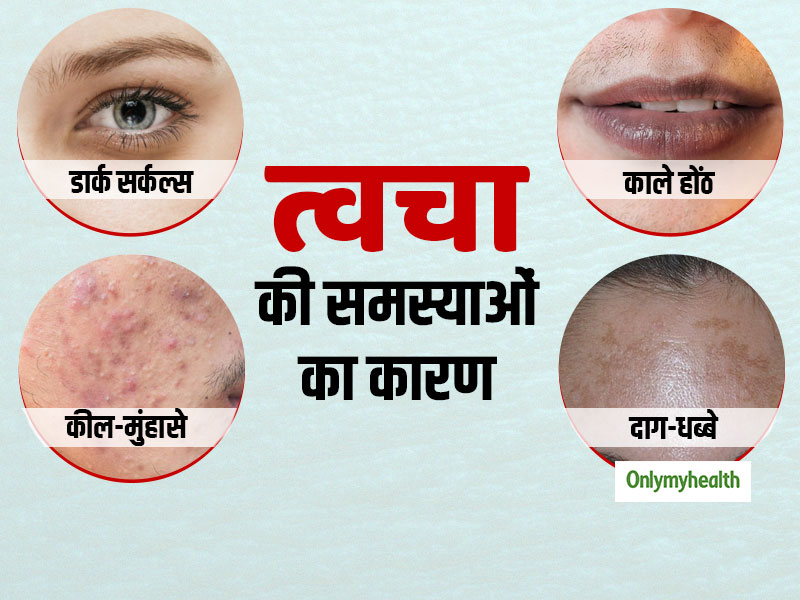 त्वचा की इन 4 समस्याओं का कारण बनती है आपकी खराब डाइट, जानें खूबसूरत त्वचा के लिए क्या खाना चाहिए?