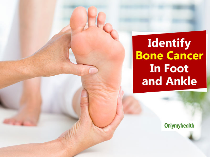 Major Signs That Indicate Bone Cancer In Foot And Ankle OnlyMyHealth