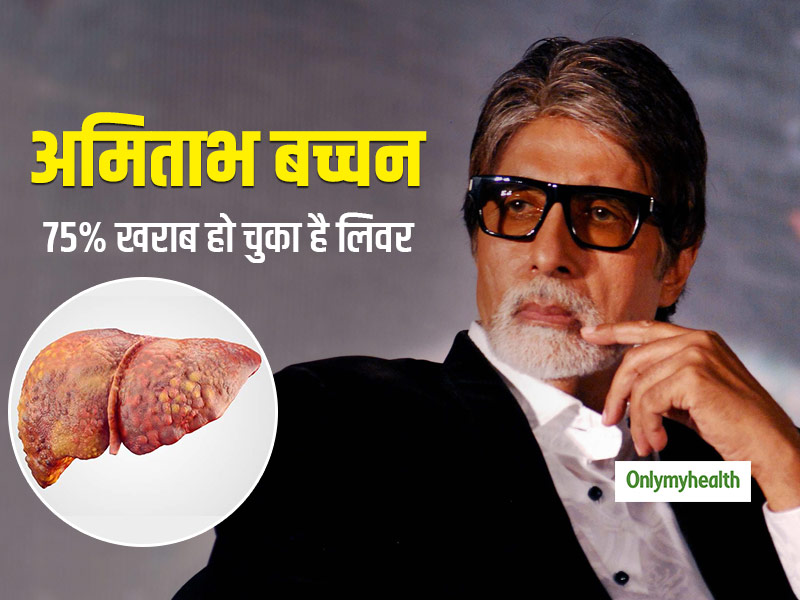 World Hepatitis Day 2020: Amitabh Bachchan Has Hepatitis Disease 75 ...