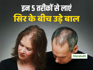 सिर के बीच से उड़ गए हैं बाल तो ये 5 घरेलू नुस्खे उन्हें वापस लाने में हैं मददगार, करने में हैं बेहद आसान