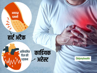 हार्ट अटैक और कार्डियक अरेस्‍ट में क्‍या अंतर है, इन स्थितियों में पेशेंट को जान बचाने के लिए करना चाहिए?