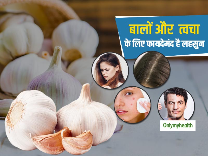 Garlic Benefits: त्‍वचा और बालों की बीमारियों के लिए रामबाण है लहसुन, जानें इसके फायदे और प्रयोग