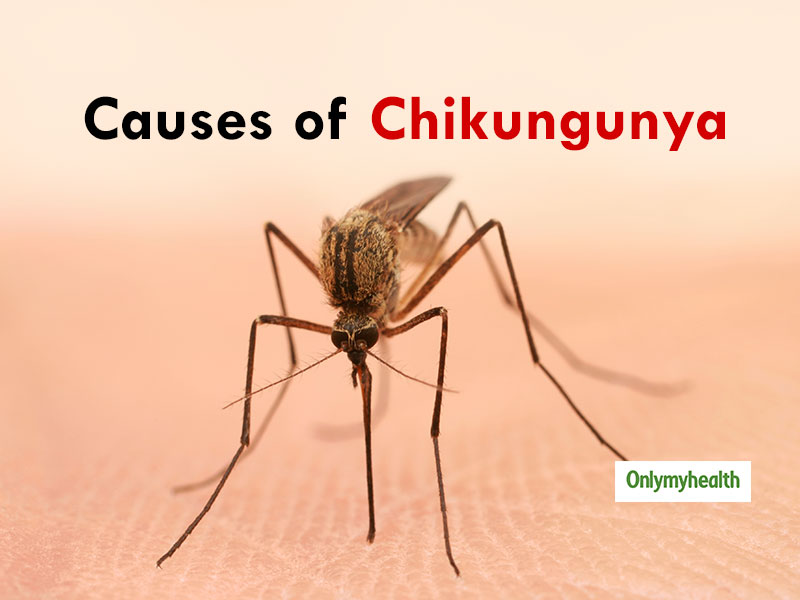 what-are-the-causes-of-chikungunya-onlymyhealth