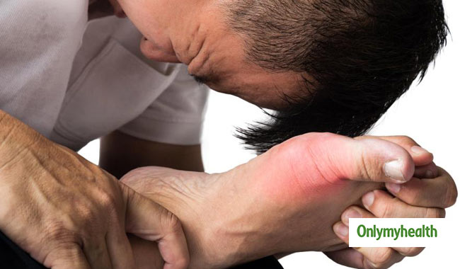 Suffering From Gout? Know It's Types And Risk Factors