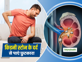 Kidney Stone Pain Remedies: किडनी स्‍टोन के दर्द से राहत दिलाएंगेे ये 5 घरेलू नुस्‍खे, जानें प्रयोग का तरीका   