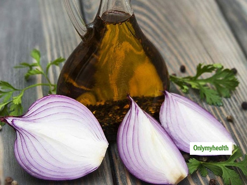 How Onion Oil Helps In Hair Growth In Hindi | बालों के लिए प्‍याज से  ज्‍यादा उसका तेल है फायदेमंद