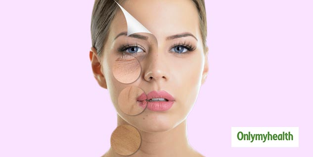 laser treatment