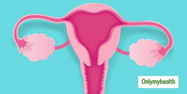 PCOS Problem in Women 
