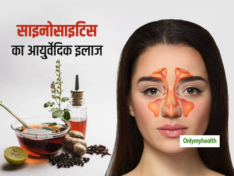 आयुर्वेद के अनुसार साइनोसाइटिस (साइनस) की बीमारी से छुटकारा दिलाने वाले आहार और घरेलू नुस्खे
