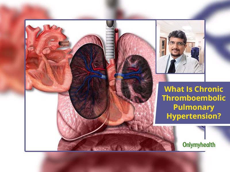 pulmonary-hypertension-acha