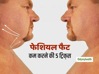Weight Loss: झूलते और गोल-मटोल गालों से हैं परेशान? तो अपनाएं फेशियल फैट को कम करने की 5 ईजी ट्रिक्‍स 