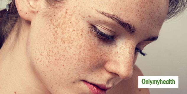 Cranberries For Pigmentation