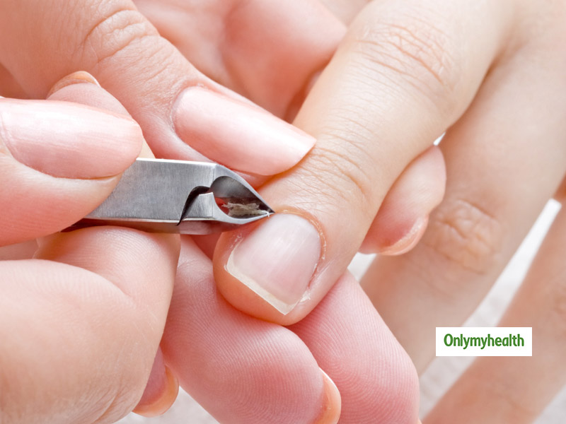 Get Rid Of Hangnails In The Easiest and Painless Way