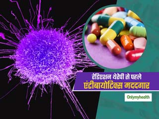 रेडिएशन थेरेपी से पहले एंटीबायोटिक लेना हो सकता है कैंसर से लड़ने में मददगार, शोध में हुआ खुलासा