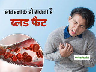 खून में बढ़ा हुआ ट्राईग्लिसराइड (ब्लड फैट) हो सकता है खतरनाक, सूजन के कारण डैमेज हो सकते हैं अंग: रिसर्च