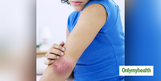 inside-Pustular psoriasis