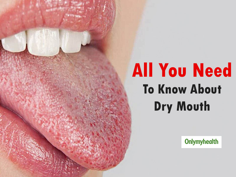 if-you-have-dry-mouth-do-not-take-it-casually-onlymyhealth