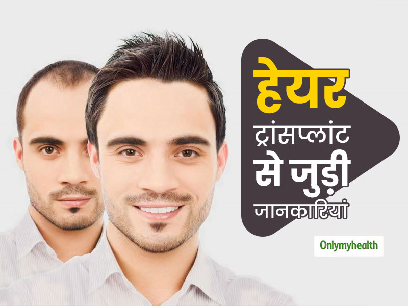 Hair Transplant Treatment Process And Hair Care In Hindi | हेयर  ट्रांसप्लांट के बाद कैसे करें बालों की देखभाल ताकि न टूटे बाल, एक्सपर्ट से  जानें सभी जरूरी जानकारियां