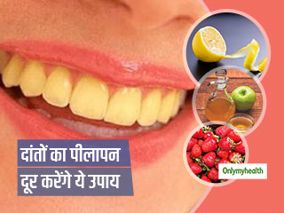 Home Remedies: बार-बार ब्रश करने से भी नहीं जा रहा दांतों का पीलापन, तो आजमाएं ये 5 असरदार घरेलू उपाय